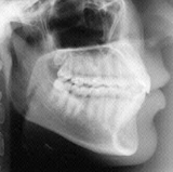Radiologia Odontológica em Palmas
